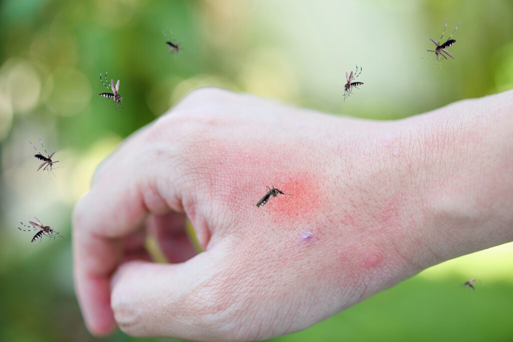 ER Pest and Termite mosquito spraying gets rid of biting mosquitoes.